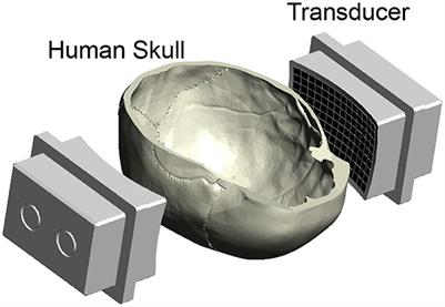 Controlled ultrasonic interventions through the human skull